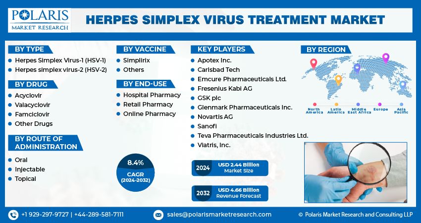 Herpes Simplex Virus